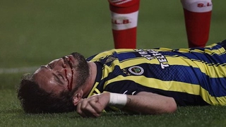 Cầu thủ bất tỉnh trong trận Fenerbahce thua Benfica