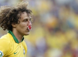 Sao Chelsea bị vỡ mũi tại Confed Cup