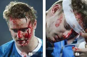 Lewandowski phang đối thủ máu me be bét