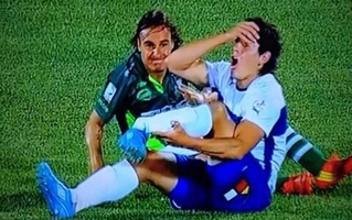 Pha gãy chân kinh hoàng của sao Chilê