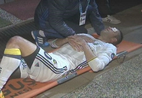 Cựu sao MU suýt mù mắt vì va chạm trên sân