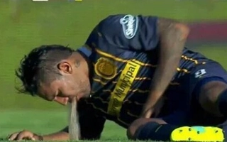 Nhiều khả năng anh này uống rượu trước khi chơi bóng